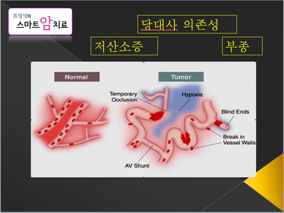 정상혈관과 암혈관 비교